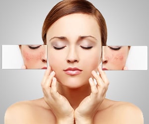 Осветление кожи