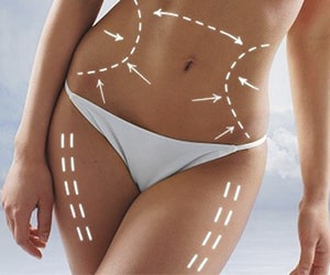 Обертывания для похудения